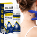 Timilk ChillErase Bump Renewal Spray Reduce Body Acne Skin Soothing Formula 60ML